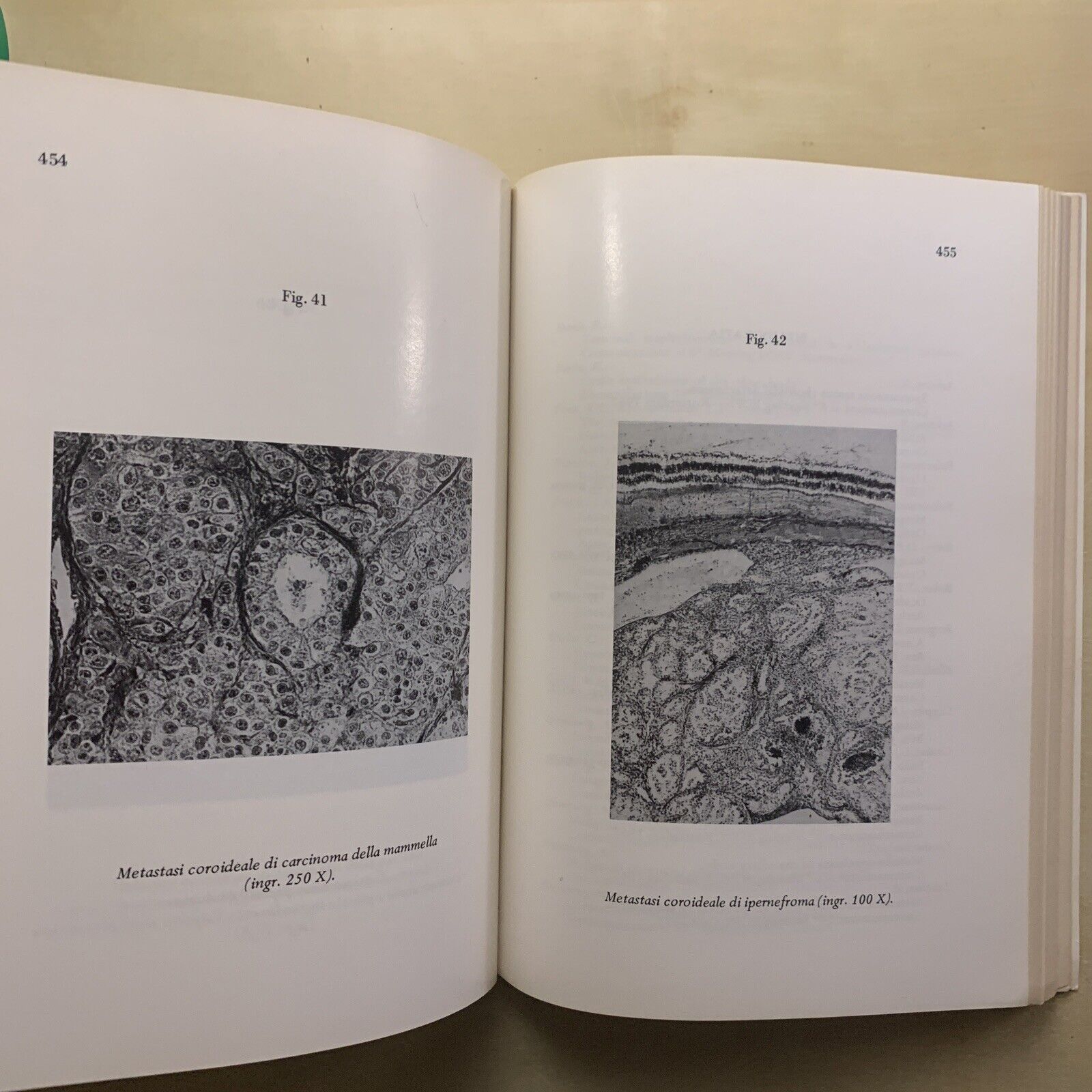 SIMPOSIO INTERNAZIONALE SULL'UVEA. SYMPOSIUM INTERNATIONAL SUR L'UVÉE. PAVESE