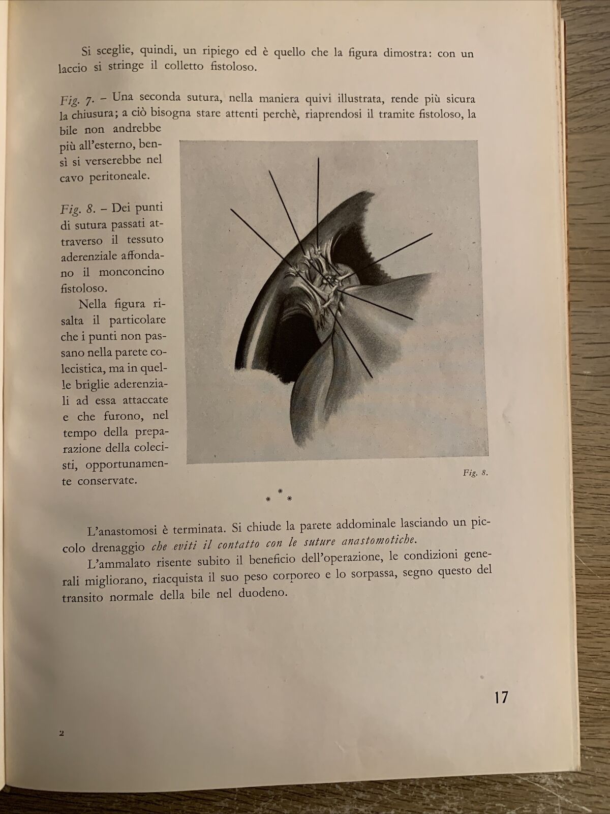OPERAZIONI CHIRURGICHE. A. CIMINIATA. VOLUME TERZO. HOEPLI 1939