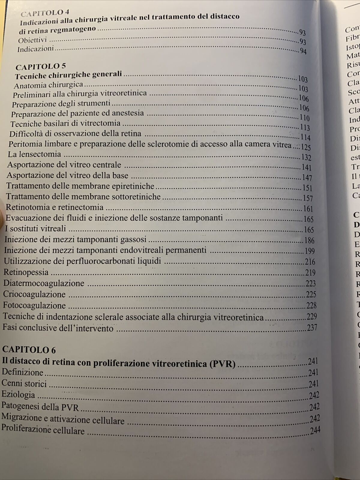 LA CHIRURGIA VITREORETINICA NEL DISTACCO DI RETINA REGMATOGENO. Molfetta Ghedini