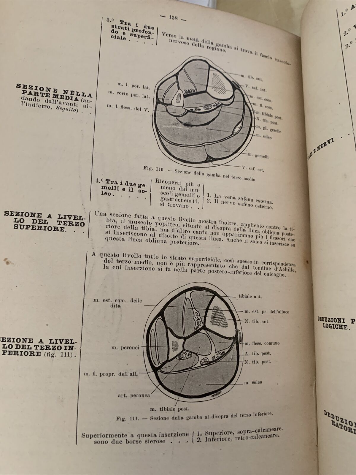 ANATOMIA TOPOGRAFICA E CHIRURGICA - Dr. Boutigny 1901. Soc. Editrice libraria #