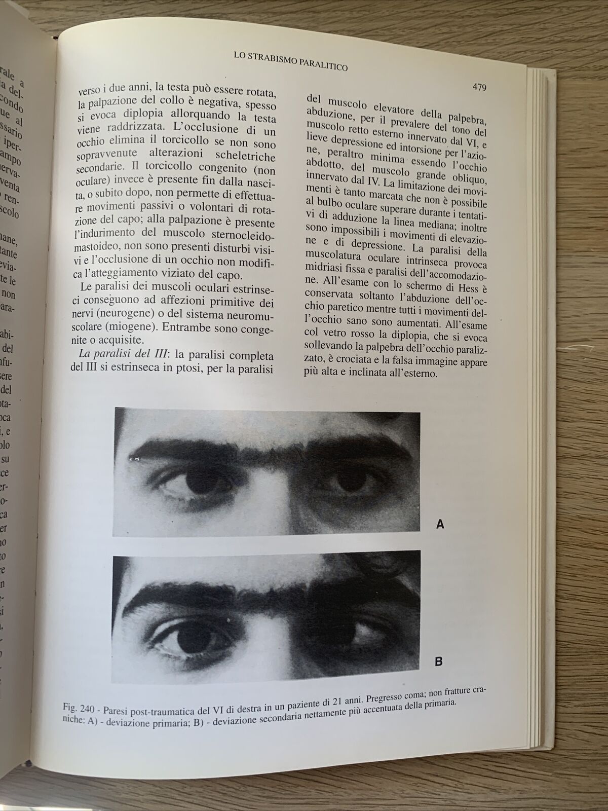 NEUROFTALMOLOGIA - FRANCESCO CARTA, EDIZIONI SBM 1997 #