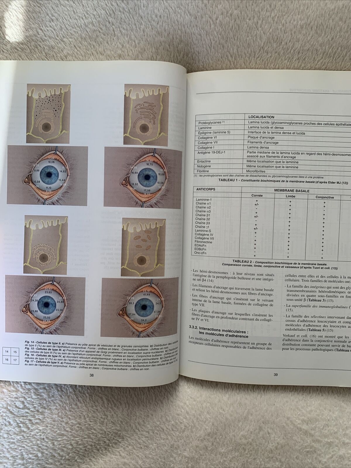 Inflammation chronique de la conjonctive, Thanh Hoang-Xuan, Hannouche, Badouin
