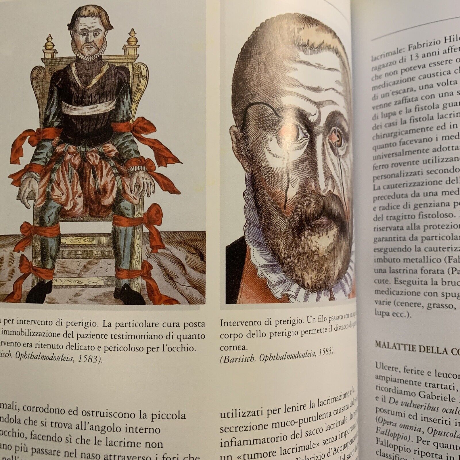 STORIA DELL'OCULISTICA VOLUME TERZO - NICOLA DELLE NOCI. EDITORE SIFI 2002