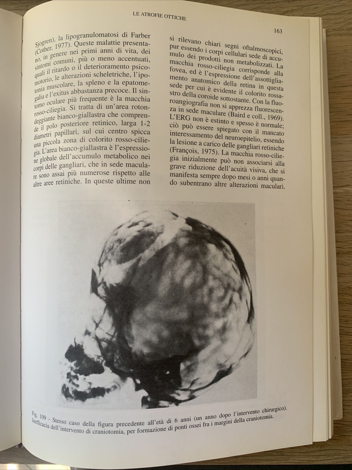 NEUROFTALMOLOGIA - FRANCESCO CARTA, EDIZIONI SBM 1997 #