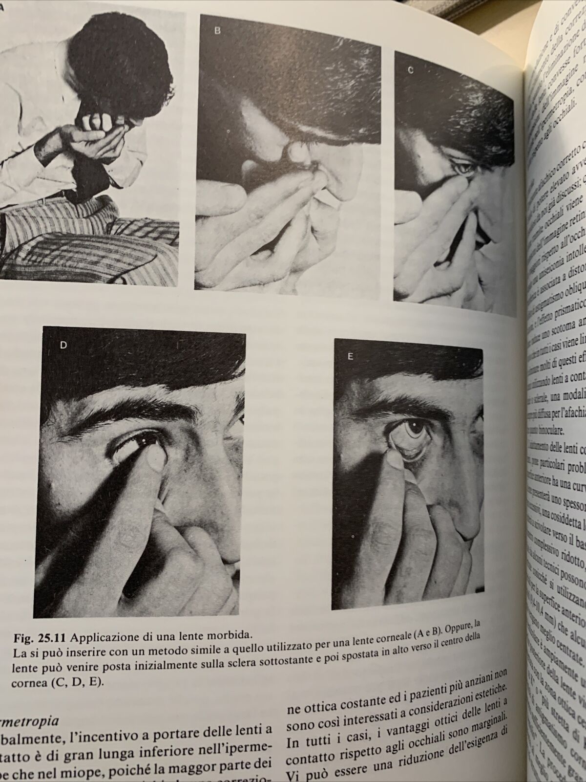PRATICA DELLA REFRAZIONE DI DUKE ELDER - David Abrams, Piccin 1988 #
