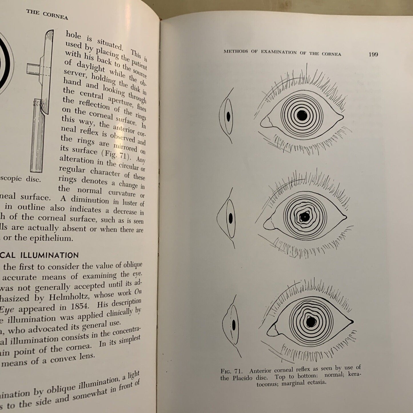 THE CORNEA - CHARLES THOMAS M. D.