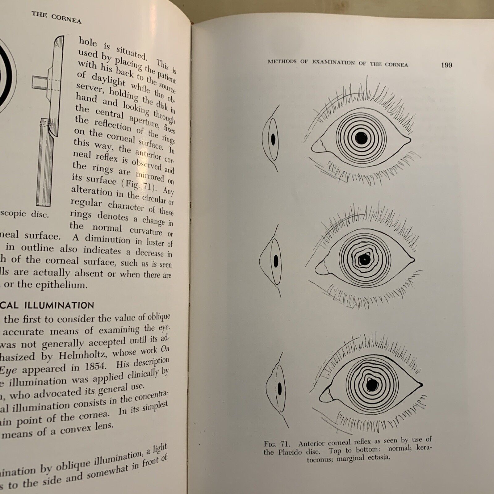 THE CORNEA - CHARLES THOMAS M. D.
