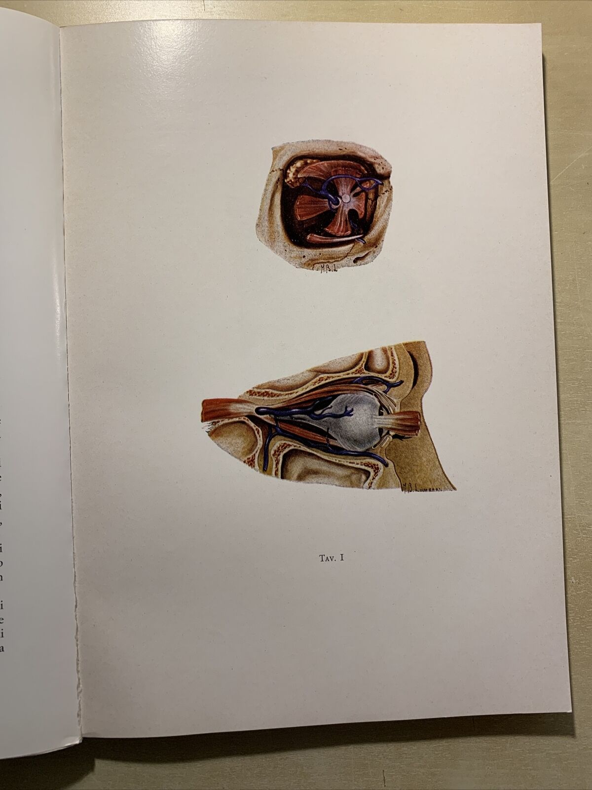 STATO ATTUALE DELLA FLEBOGRAFIA ORBITARIA - CRISTINI, CARAMAZZA, GIORDANO #