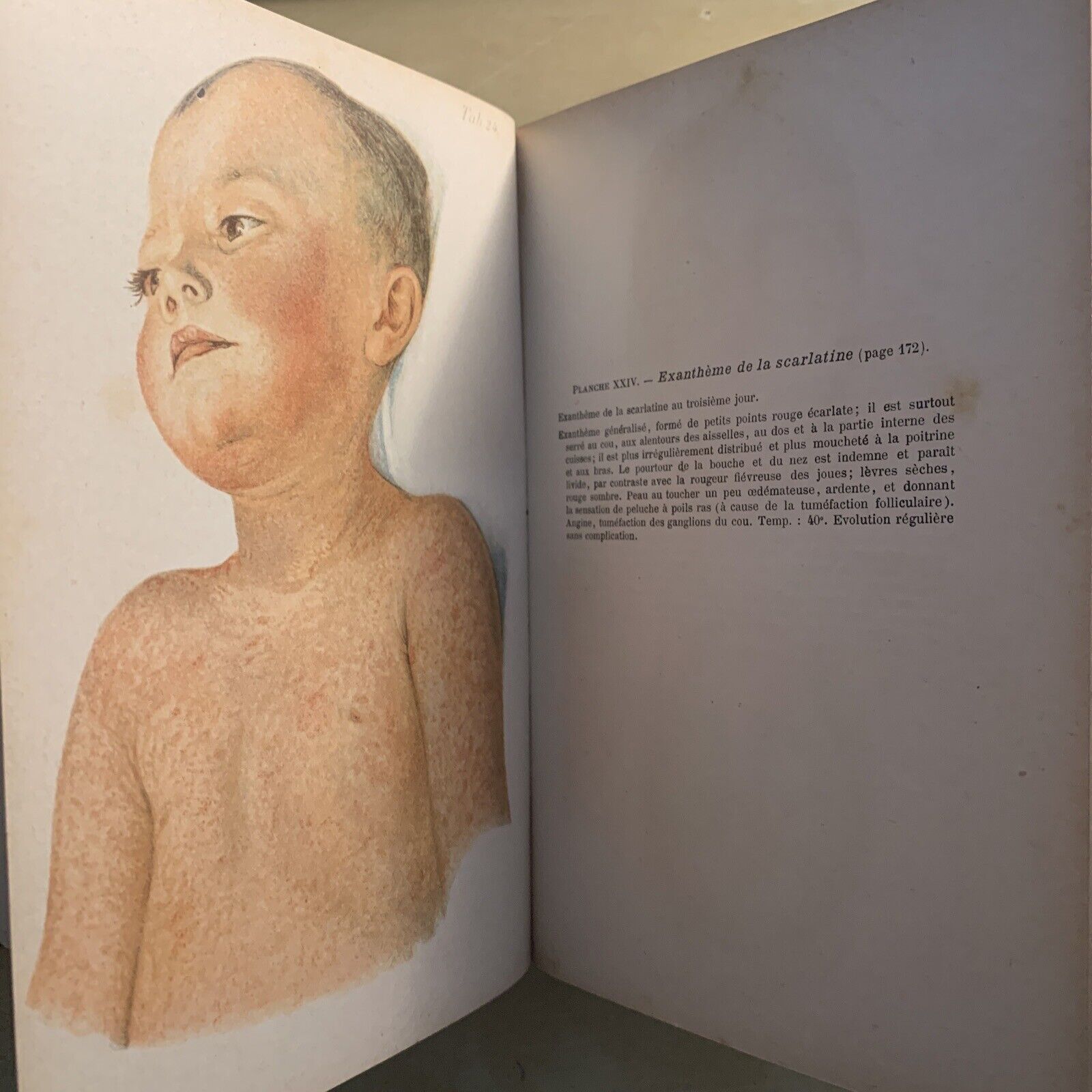 ATLAS MANUEL MALADIES DES ENFANTS. Hecker Trump Apert. Baillière & Fils 1906 #