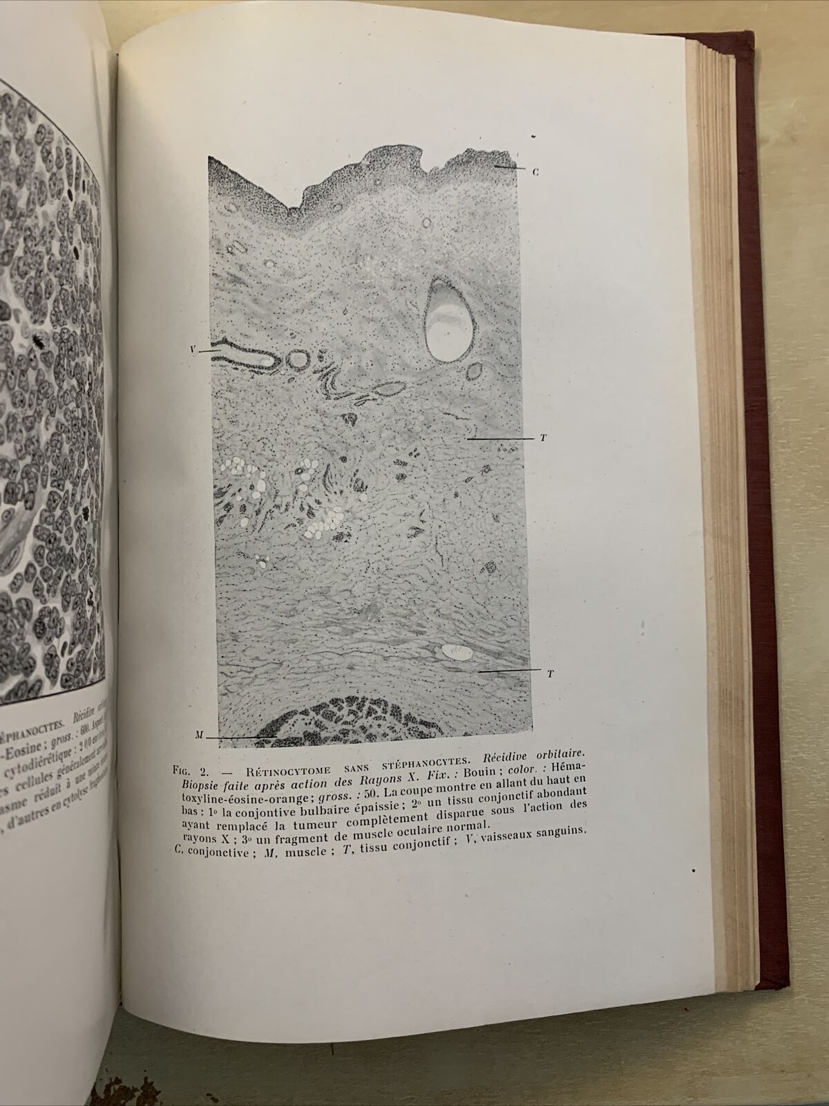 Bulletins et memoires de la société francaise d'ophtalmologie vol. XXXVI 1923