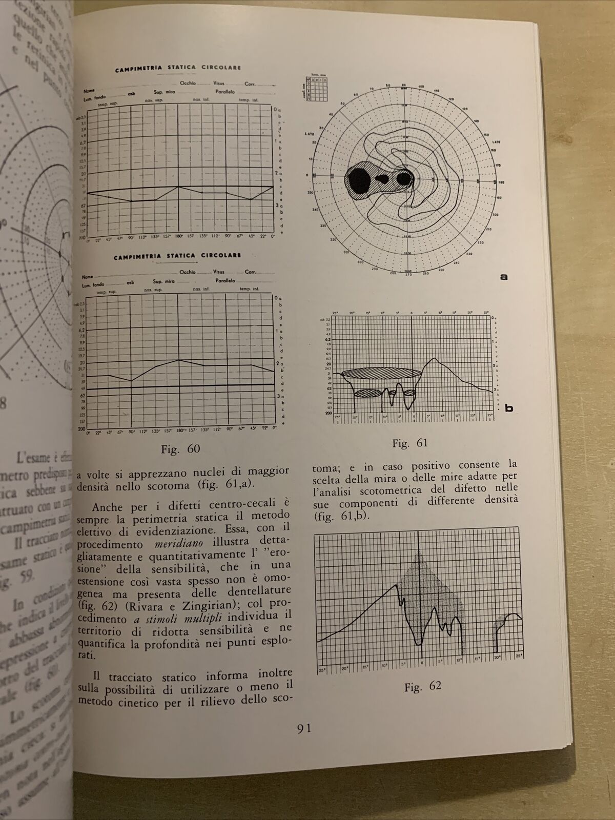 L'ESAME DEL CAMPO VISIVO - stato attuale e prospettive. Grignolo, Zingirian #