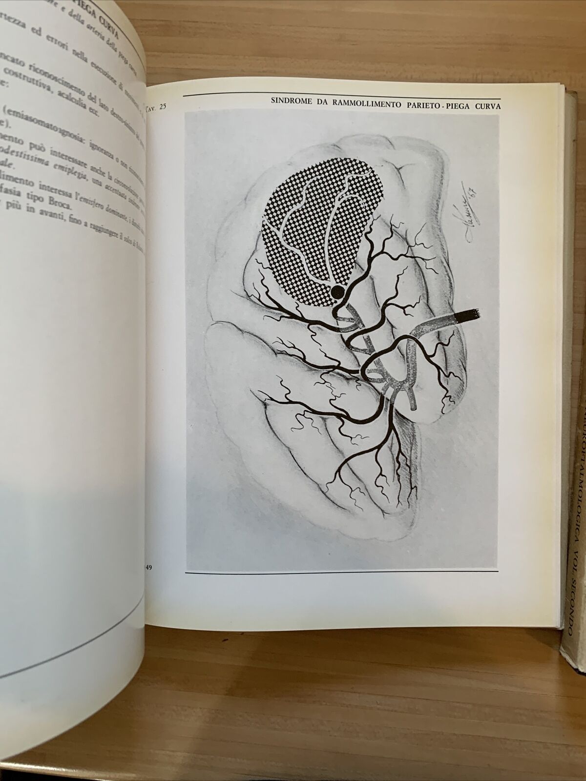 L'OCCHIO ICONOGRAFIA NEUROFTALMOLOGICA. parte seconda vol. 1 e2. Giorgio Vassura