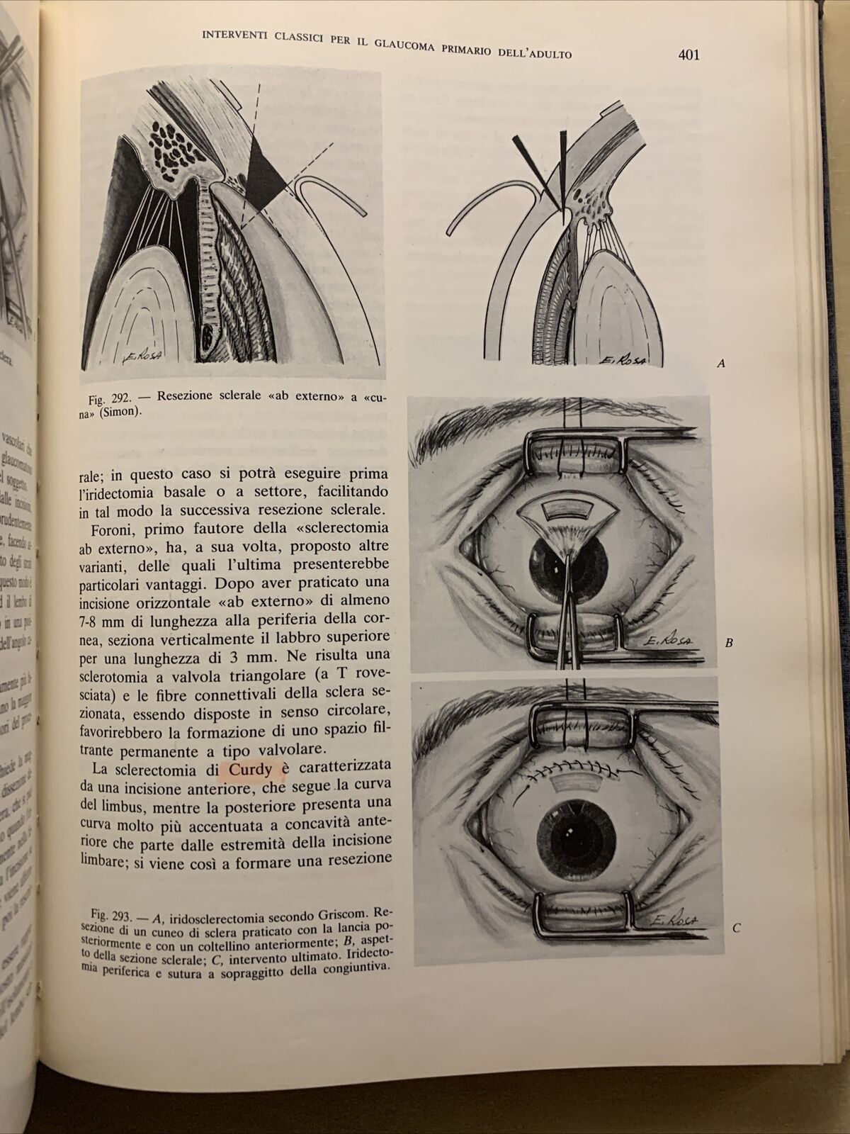 Tecnica Chirurgica. Chirurgia Oculistica UTET volume 10 - 1984 #