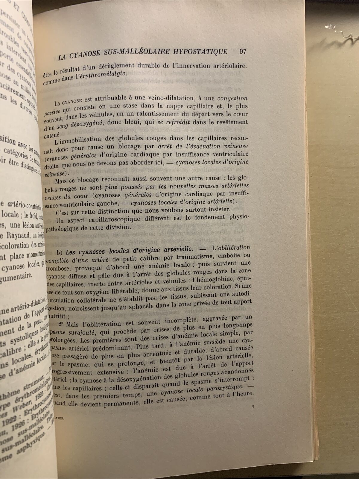 LES MALADIES DES VEINES ET LEUR TRAITEMENT - G. DELATER 1932. Masson et Cie #