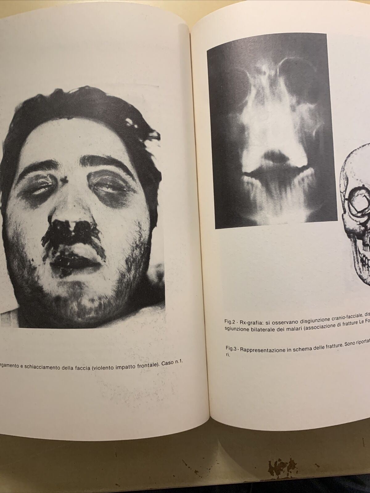 Omaggio a Paride Stefanini - Istituto Universitario di Medicina e Chirurgia 1982