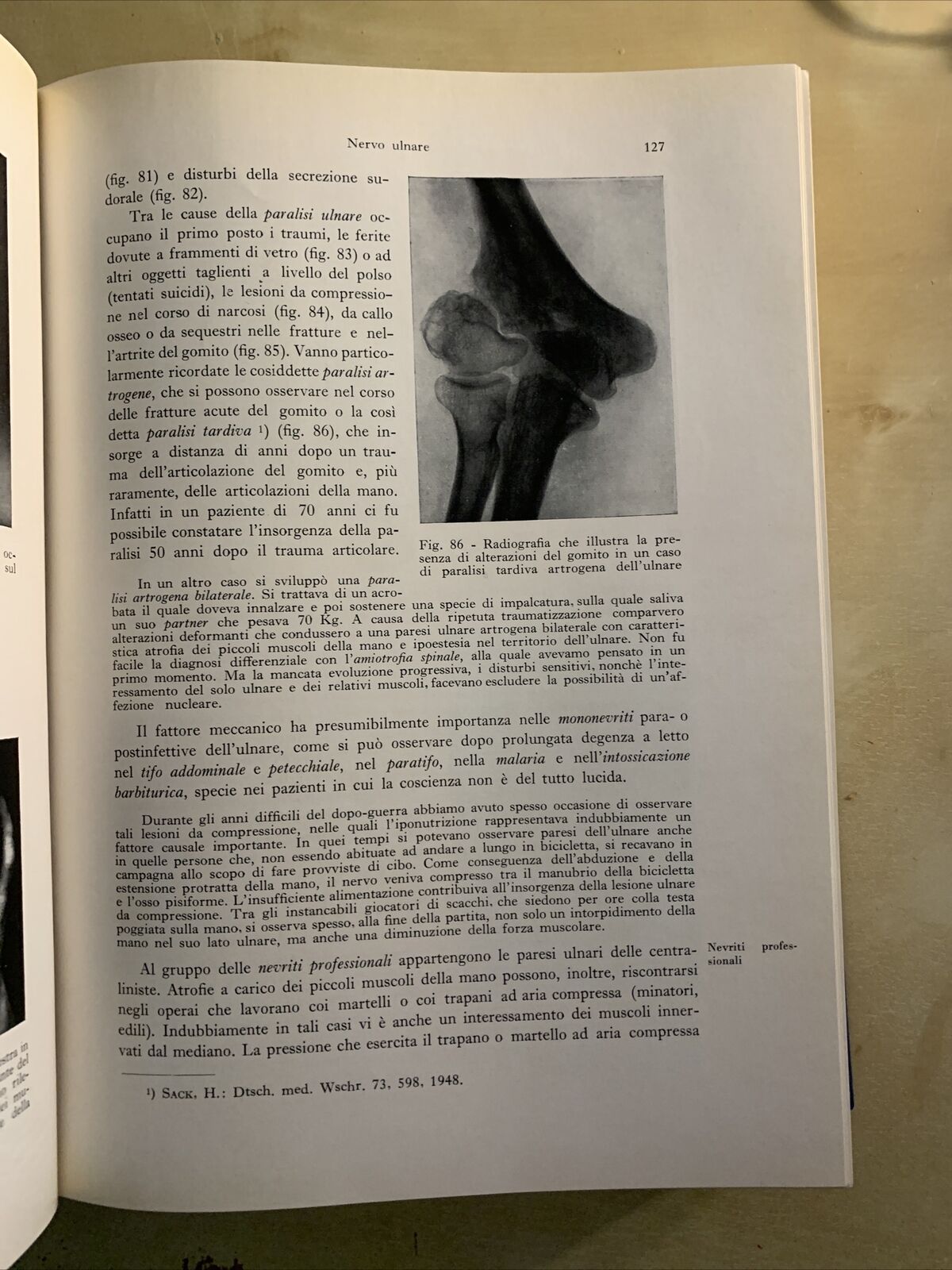 DIAGNOSI DIFFERENZIALE DELLE SINDROMI NEUROLOGICHE - BODECHTEL, ABRUZZINI 1961 #