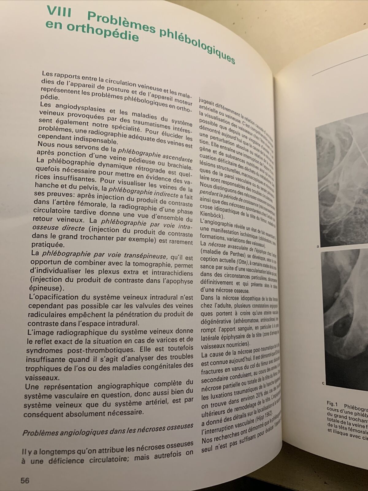 FORUM MEDICI - LES MÉDICINS PARLENT AU MÉDECIN, No 14 La phlébologie et les doma
