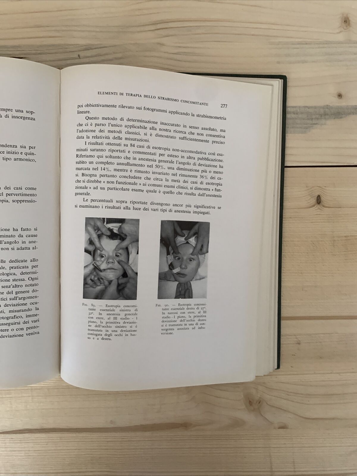 ELEMENTI DI TERAPIA DELLO STRABISMO CONCOMITANTE - ANICETO GIARDINI #
