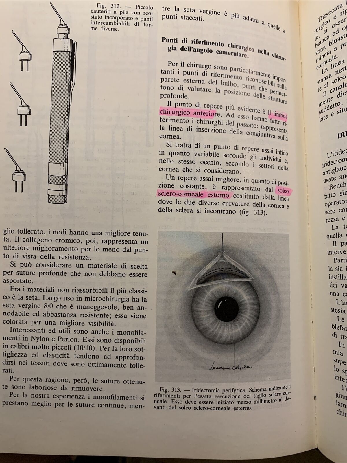 Tecnica Chirurgica. Chirurgia Oculistica UTET volume 10 - 1984 #