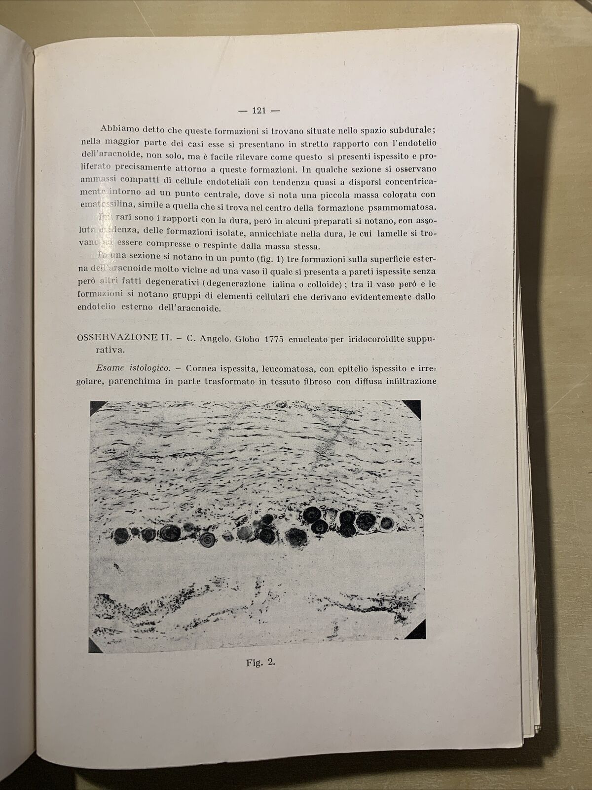 SAGGI DI OFTALMOLOGIA - clinica oculistica di Roma. Prof di Marzio 1927. vol 3 #