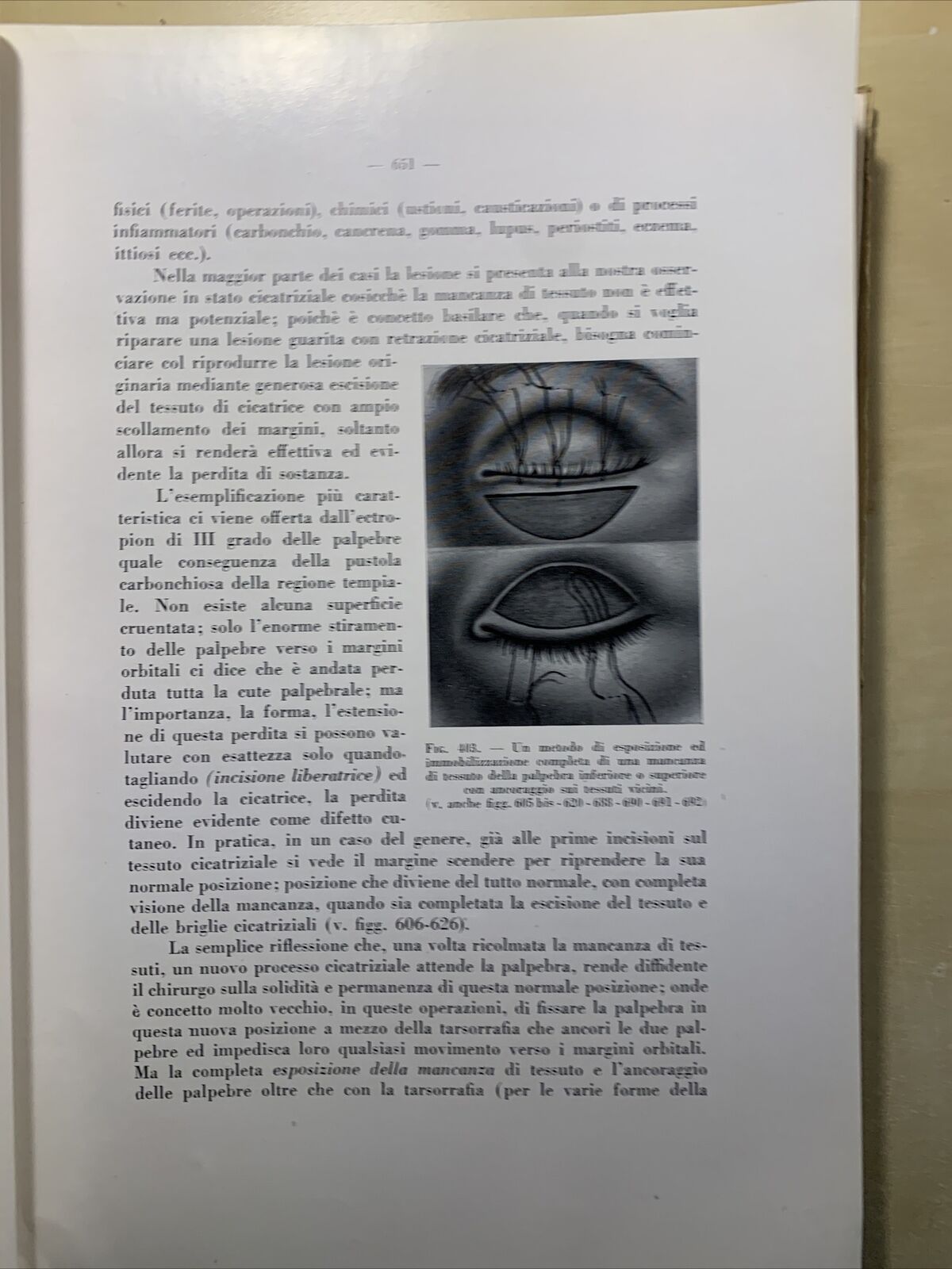 CHIRURGIA DELL'APPARATO OCULARE Volume secondo. E. LEONARDI. ARTE DELLA STAMPA #