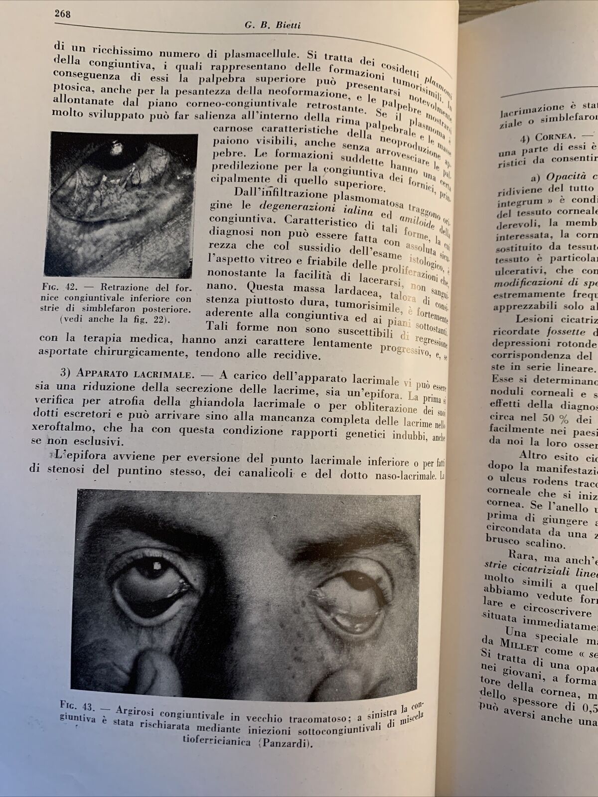 LE MANIFESTAZIONI OCULARI DELLE MALATTIE DA VIRUS E DA RICKETTSIE. CAVARA BIETTI