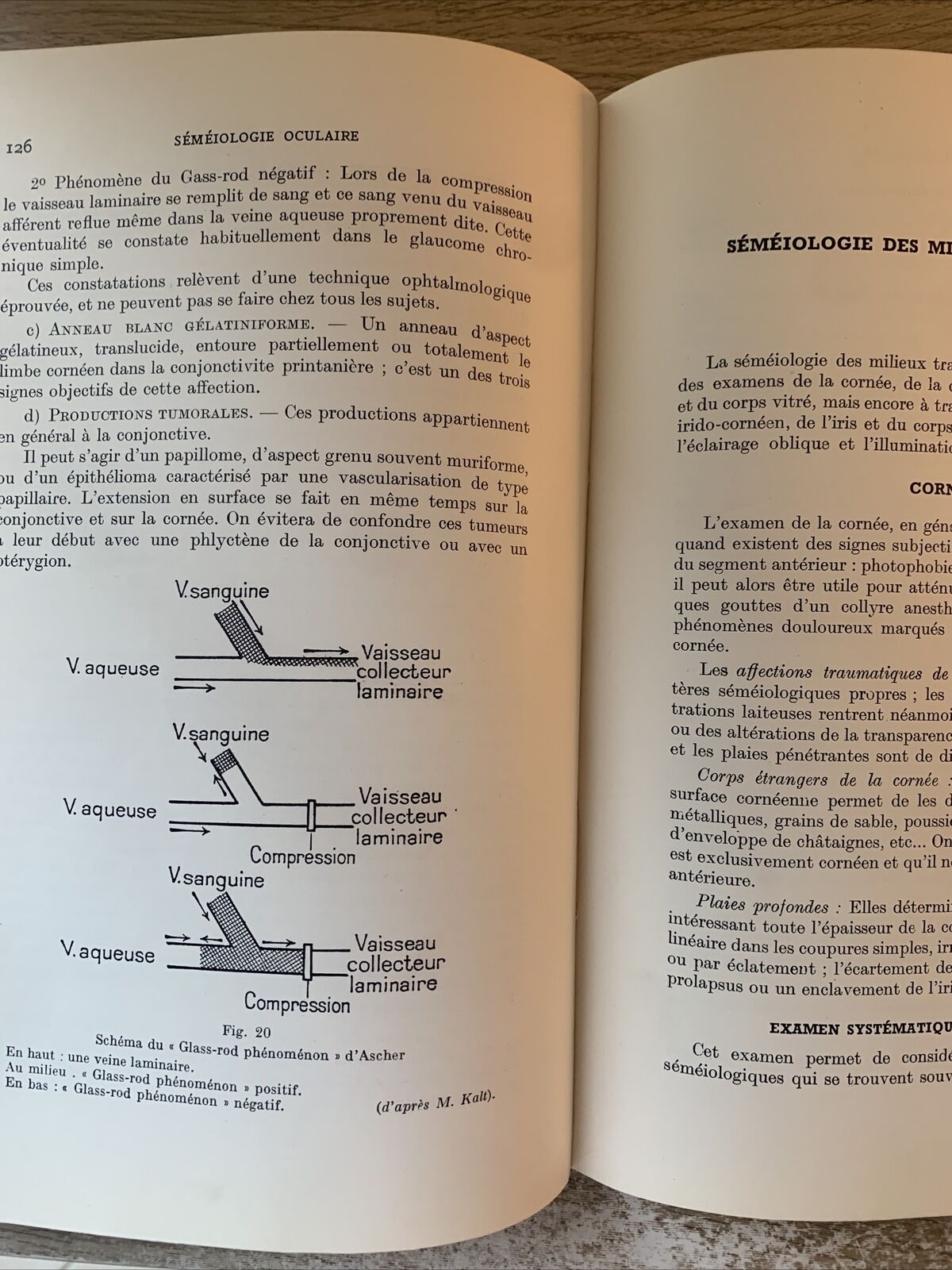 Abrégé de séméiologie oculaire, édouard Bessière. Bailliere 1954