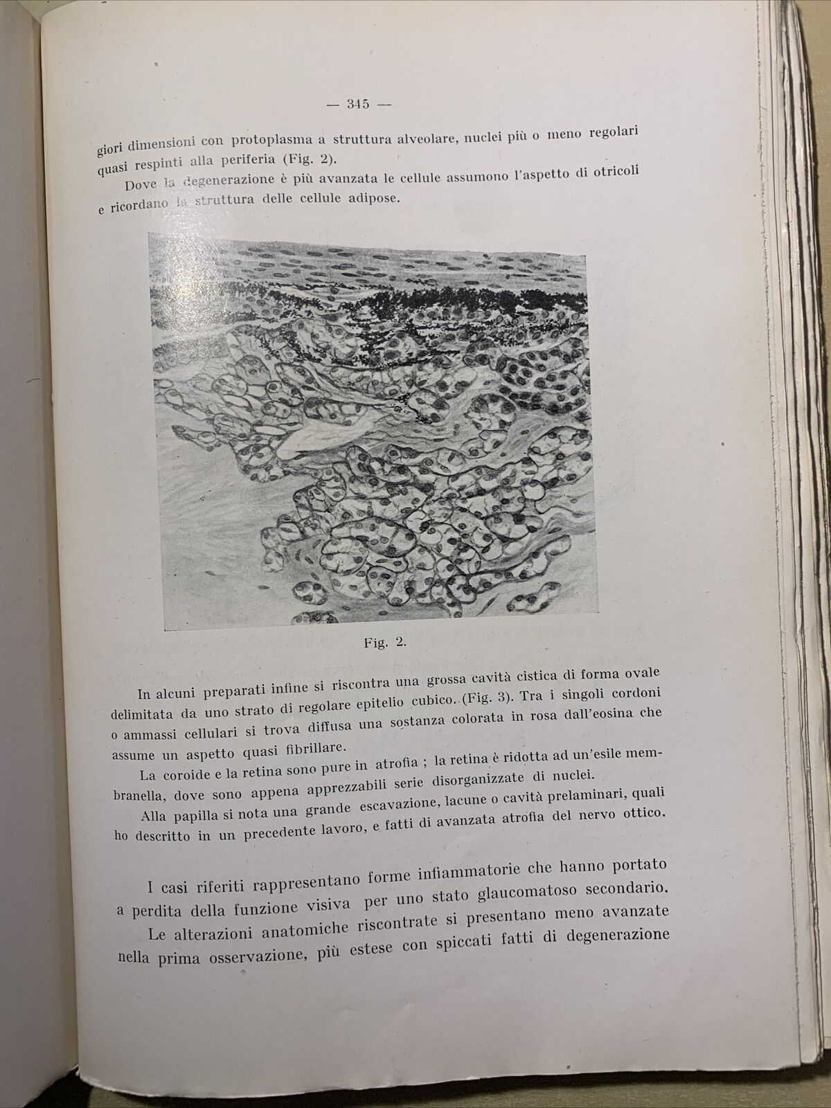 SAGGI DI OFTALMOLOGIA - clinica oculistica di Roma. Prof di Marzio 1927. vol 3 #