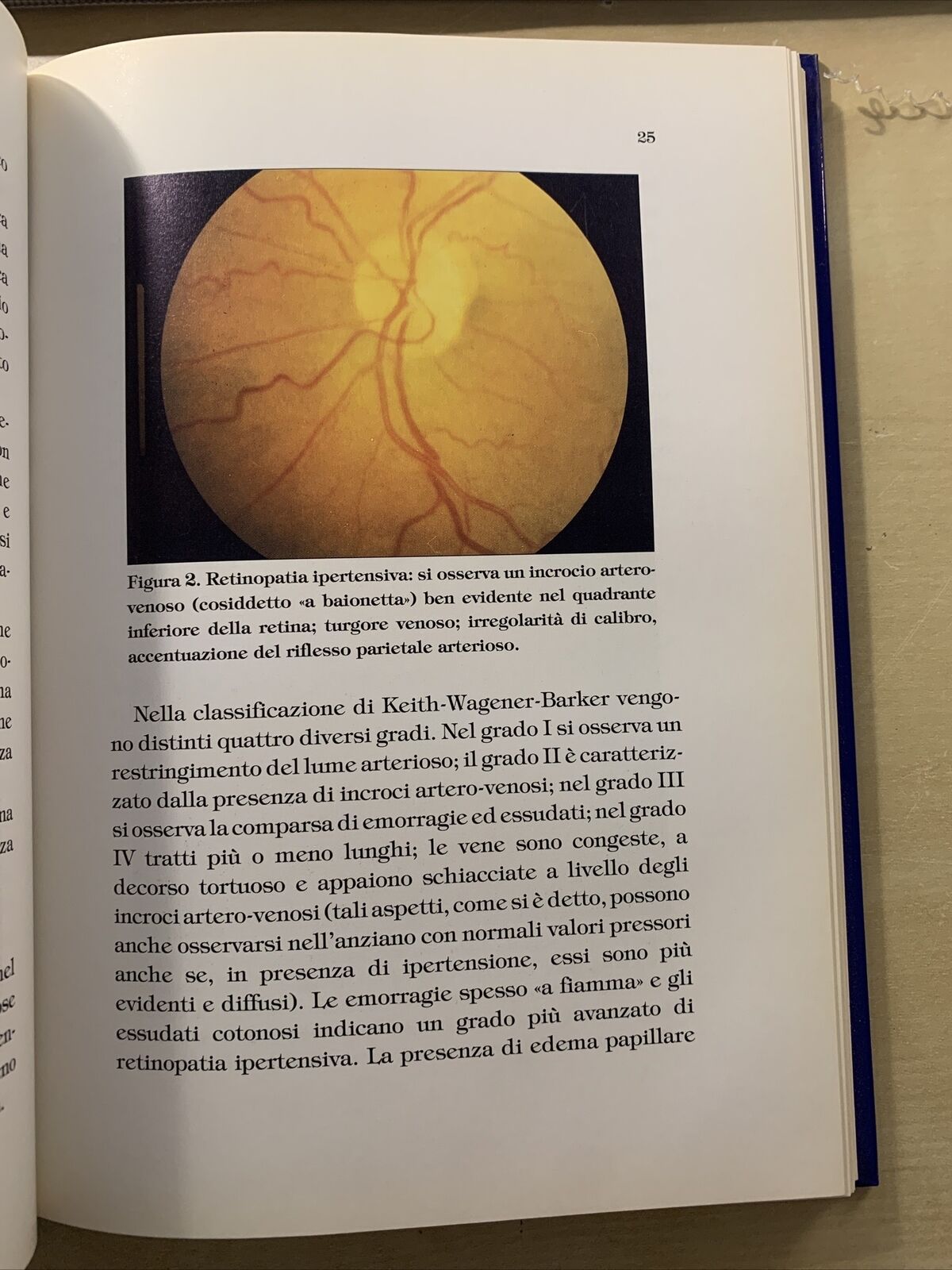 PATOLOGIA OCULARE NELL'ANZIANO - Arturo di Biase, di Benedetto. Pitagora 1995 #