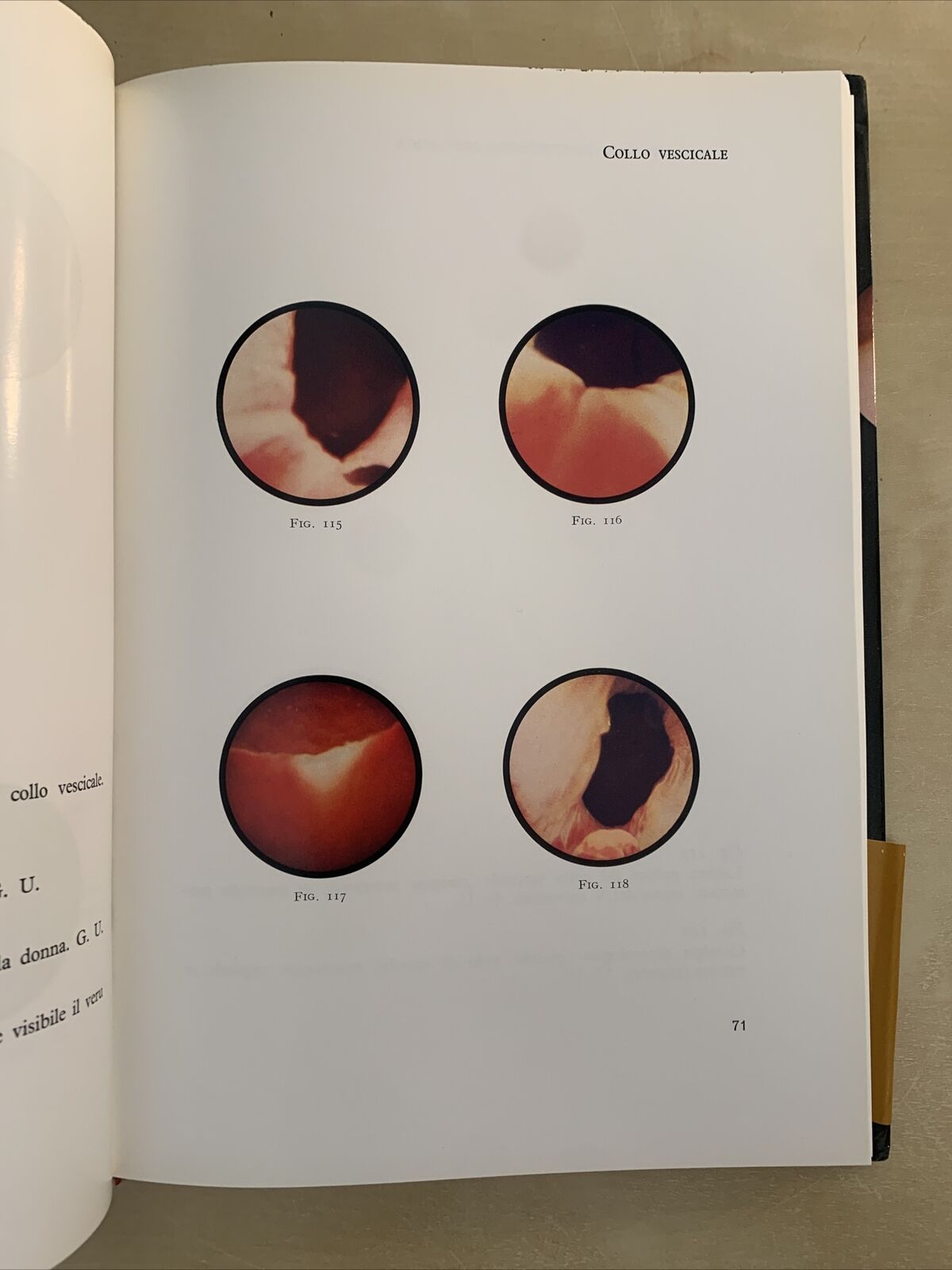 UROLOGIA ENDOSCOPICA - Rocca Rossetti, Usai, Binaghi. Editrice Universo 1970 #