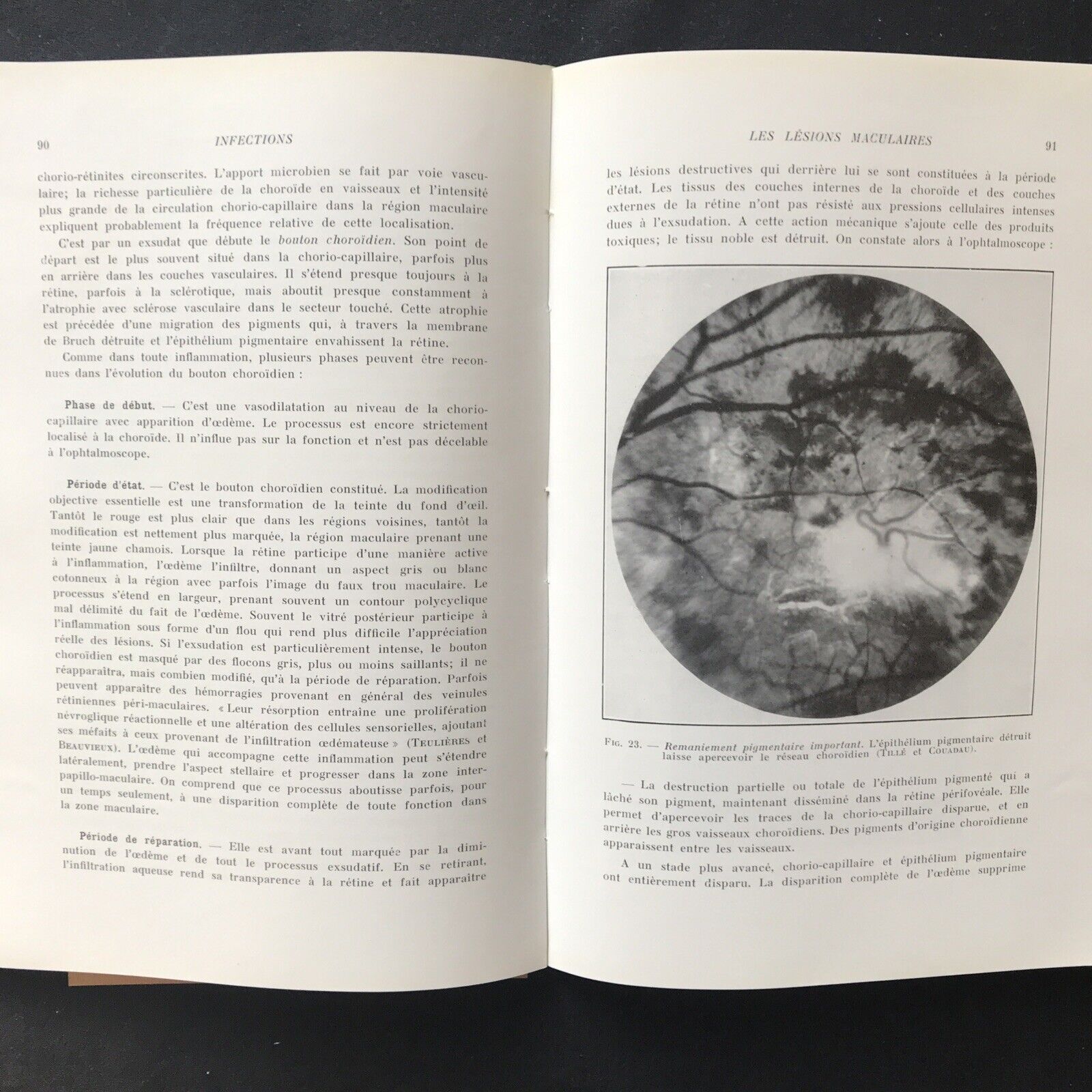 LES AFFECTIONS DE LA MACULA, Jean P. Bailliart - Masson & Cie