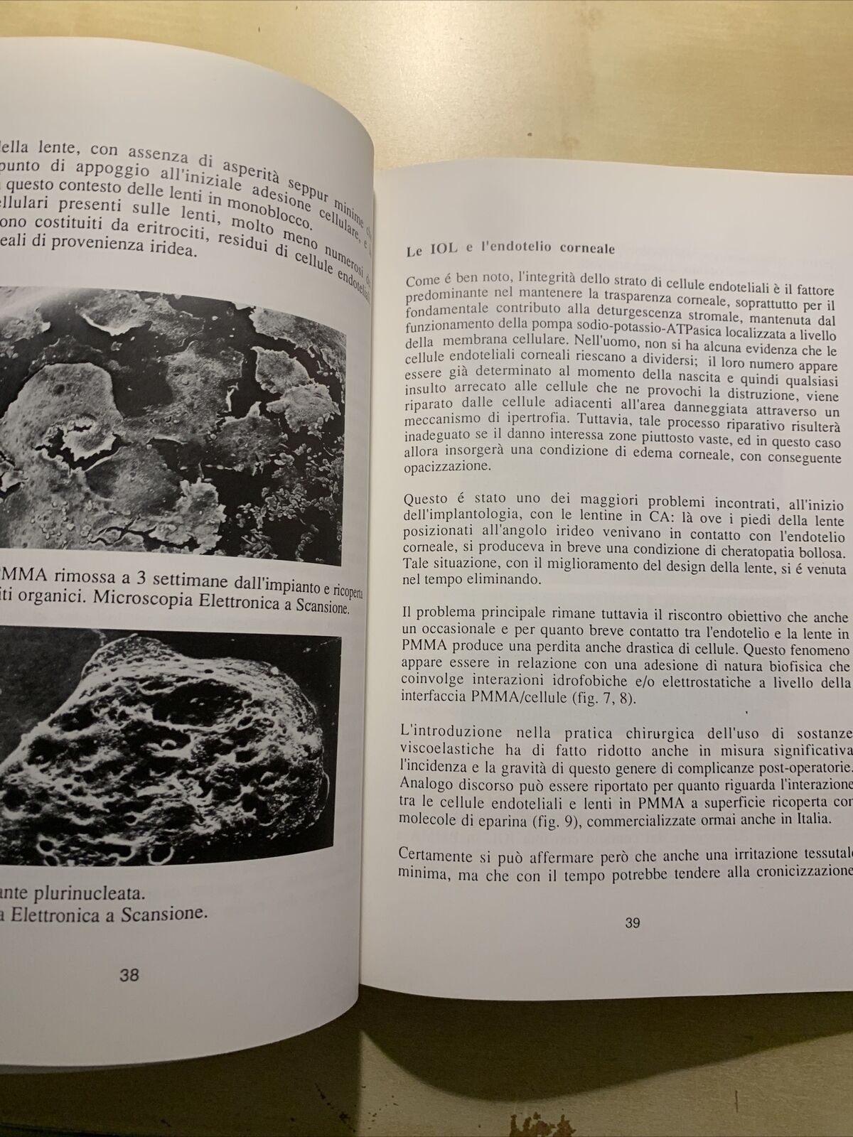 COME APRIRE GLI OCCHI SULLE IOL - CAVINA, M. GATTI, P. VERSURA, S. VOLANTI #