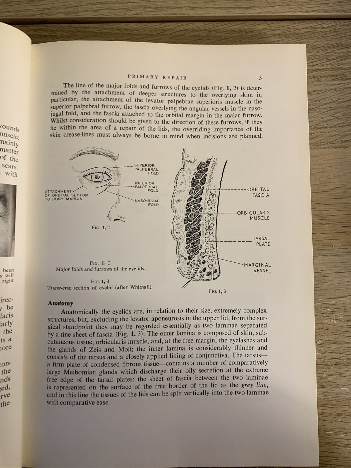 REPAIR AND RECONSTRUCTION IN THE ORBITAL REGION - MUSTARDÉ J. C. Churchill 1971