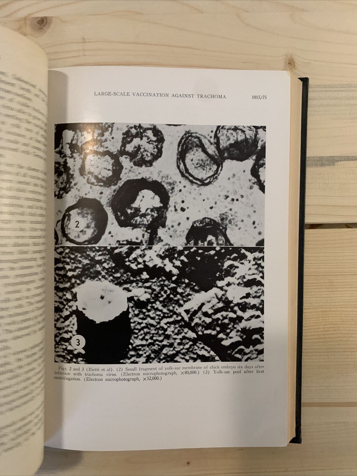 CONTRIBUTIONS TO OPHTHALMIC SCIENCE TO HONOR DERRICK TILTON VAIL, MD 1966 #