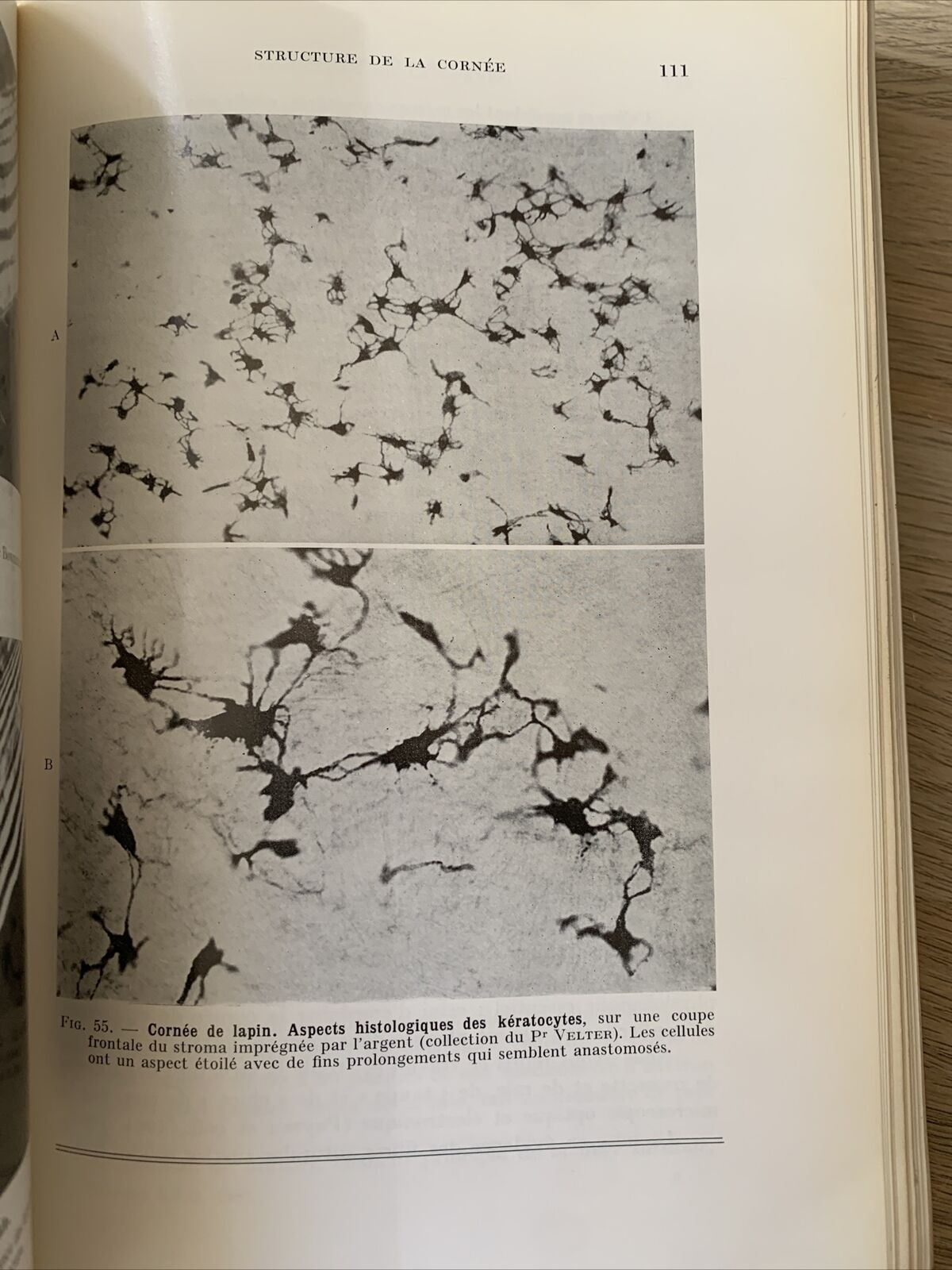 La Transparence de la Cornée, les Mécanismes de ses Altérations. Payrau 1967 #