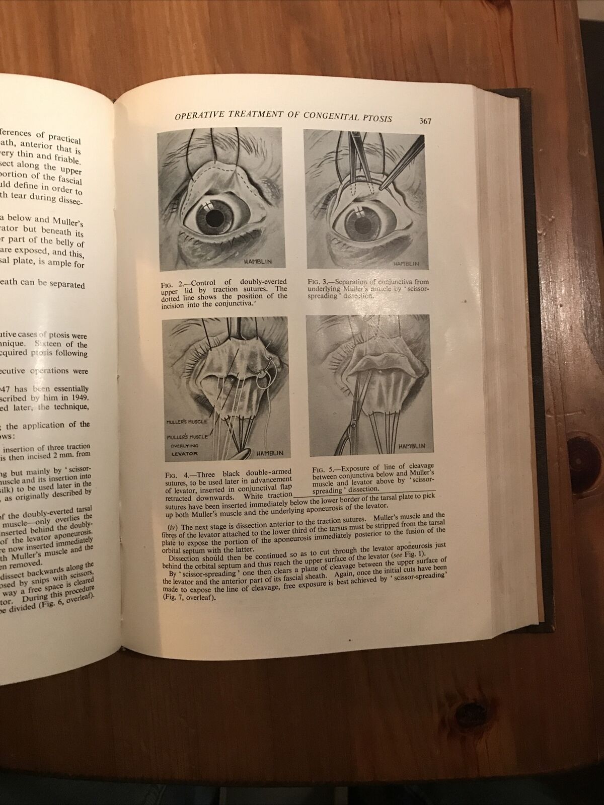 BRITISH JOURNAL OF OPHTHALMOLOGY oftalmologia, vol. XXXVI 1952 - S. Duke-Elder