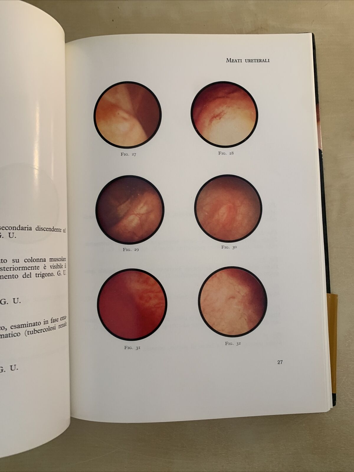 UROLOGIA ENDOSCOPICA - Rocca Rossetti, Usai, Binaghi. Editrice Universo 1970 #