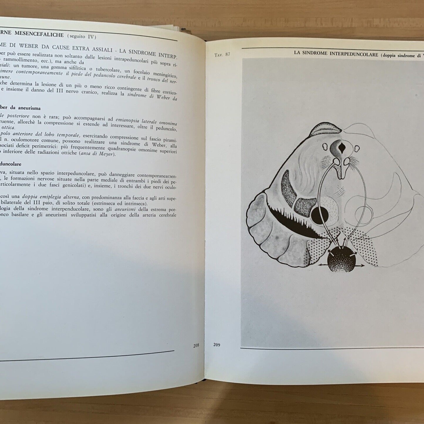 L'OCCHIO ICONOGRAFIA NEUROFTALMOLOGICA. parte seconda vol. 1 e2. Giorgio Vassura