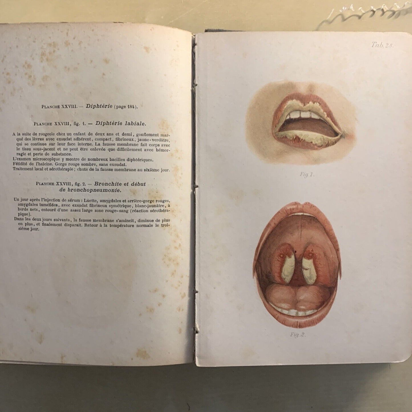 ATLAS MANUEL MALADIES DES ENFANTS. Hecker Trump Apert. Baillière & Fils 1906 #