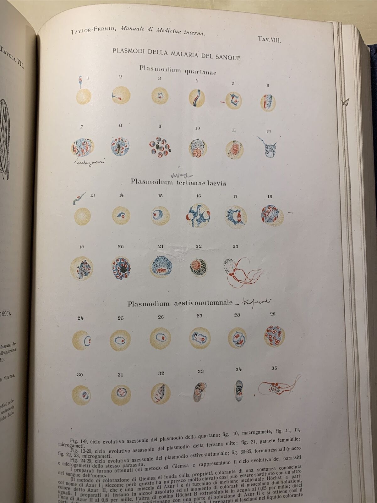 MANUALE PRATICO MEDICINA INTERNA - FEDERICO TAYLOR. UTET 1911. 2 VOLUMI #