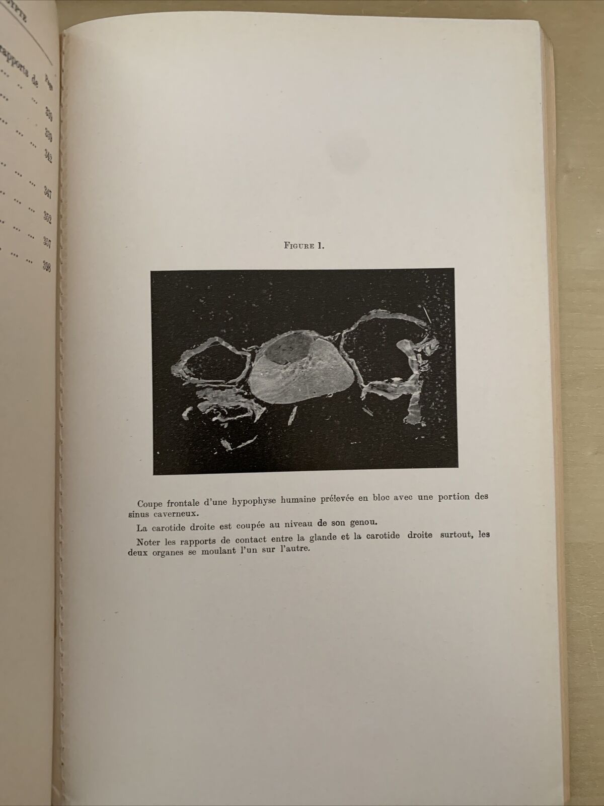 L'ENDOCRINOLOGIE ET L'OEIL. Snapper, Szily, Imre, Lo Cascio, Drouet. 1938 #