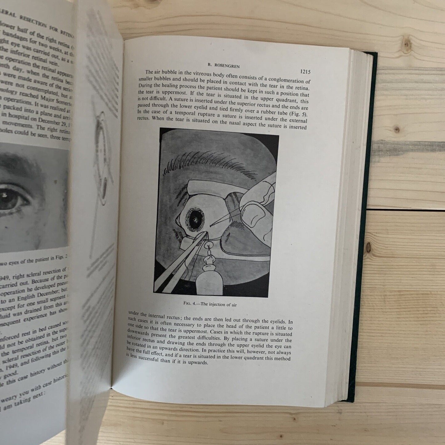 CONCILIUM OPHTHALMOLOGICUM XVI 1950 Britannia. Acta vol. II British Medical  #