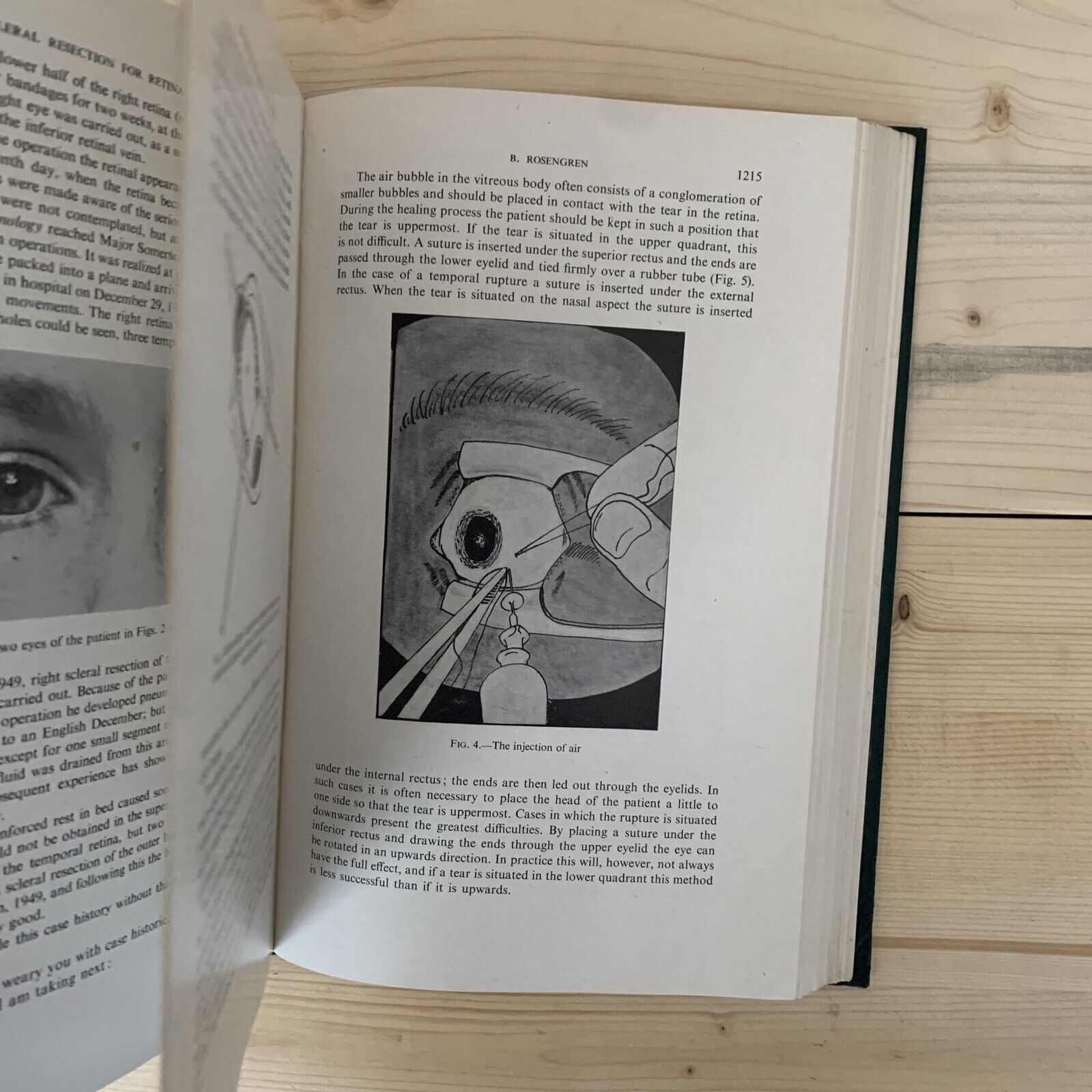 CONCILIUM OPHTHALMOLOGICUM XVI 1950 Britannia. Acta vol. II British Medical  #