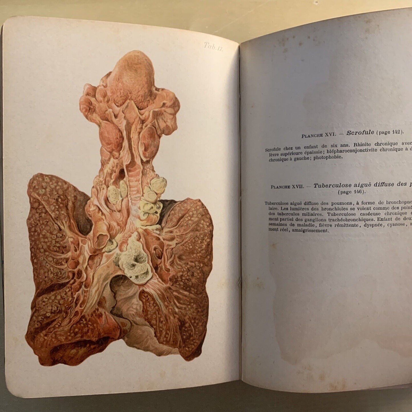 ATLAS MANUEL MALADIES DES ENFANTS. Hecker Trump Apert. Baillière & Fils 1906 #