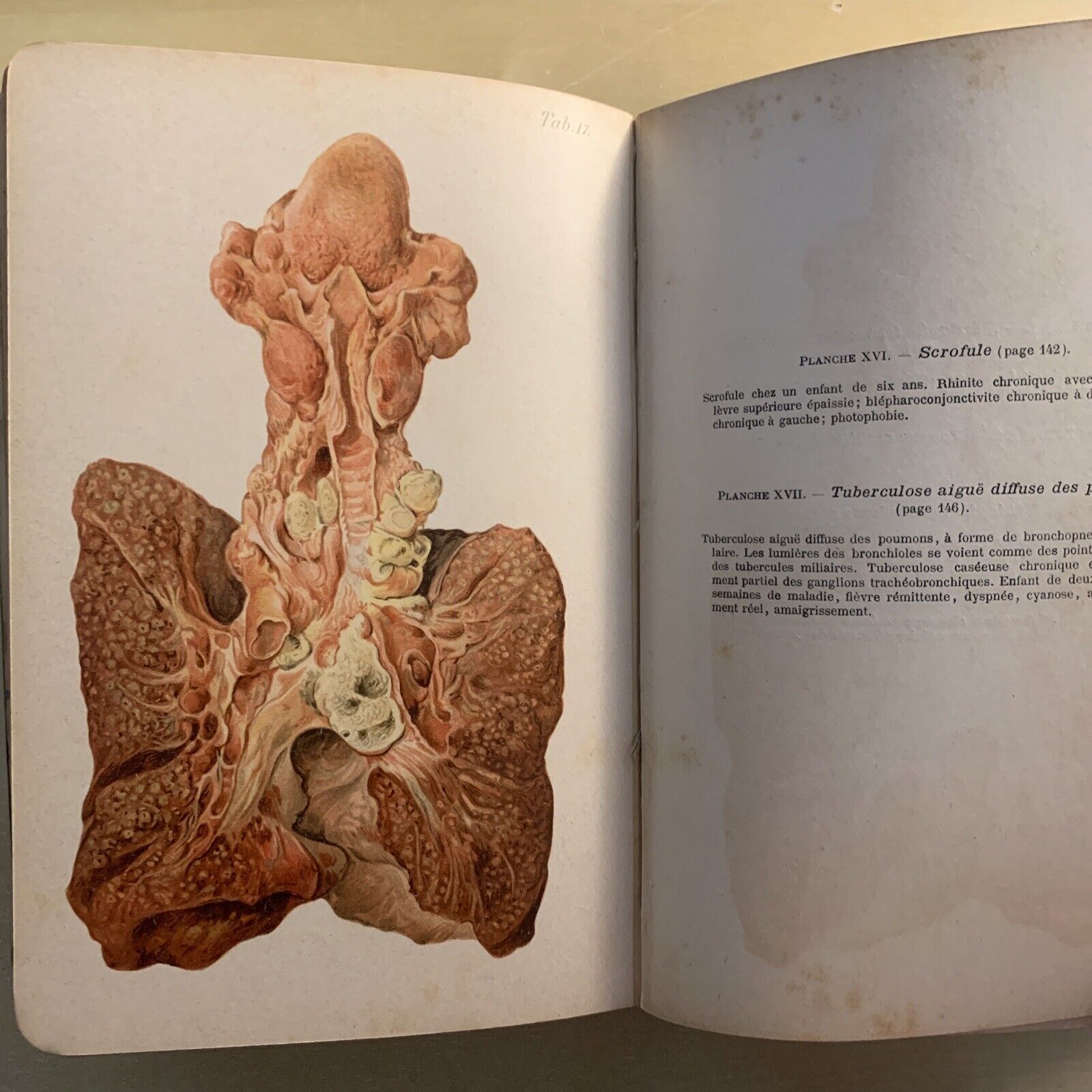 ATLAS MANUEL MALADIES DES ENFANTS. Hecker Trump Apert. Baillière & Fils 1906 #
