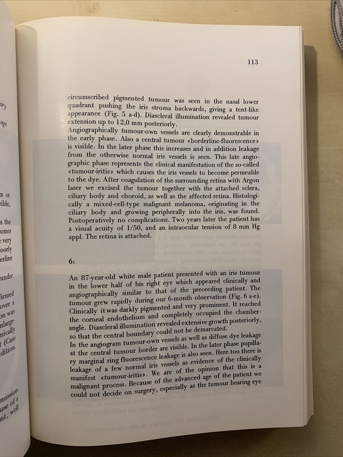 SIMPOSIO INTERNAZIONALE SULL'UVEA. SYMPOSIUM INTERNATIONAL SUR L'UVÉE. PAVESE