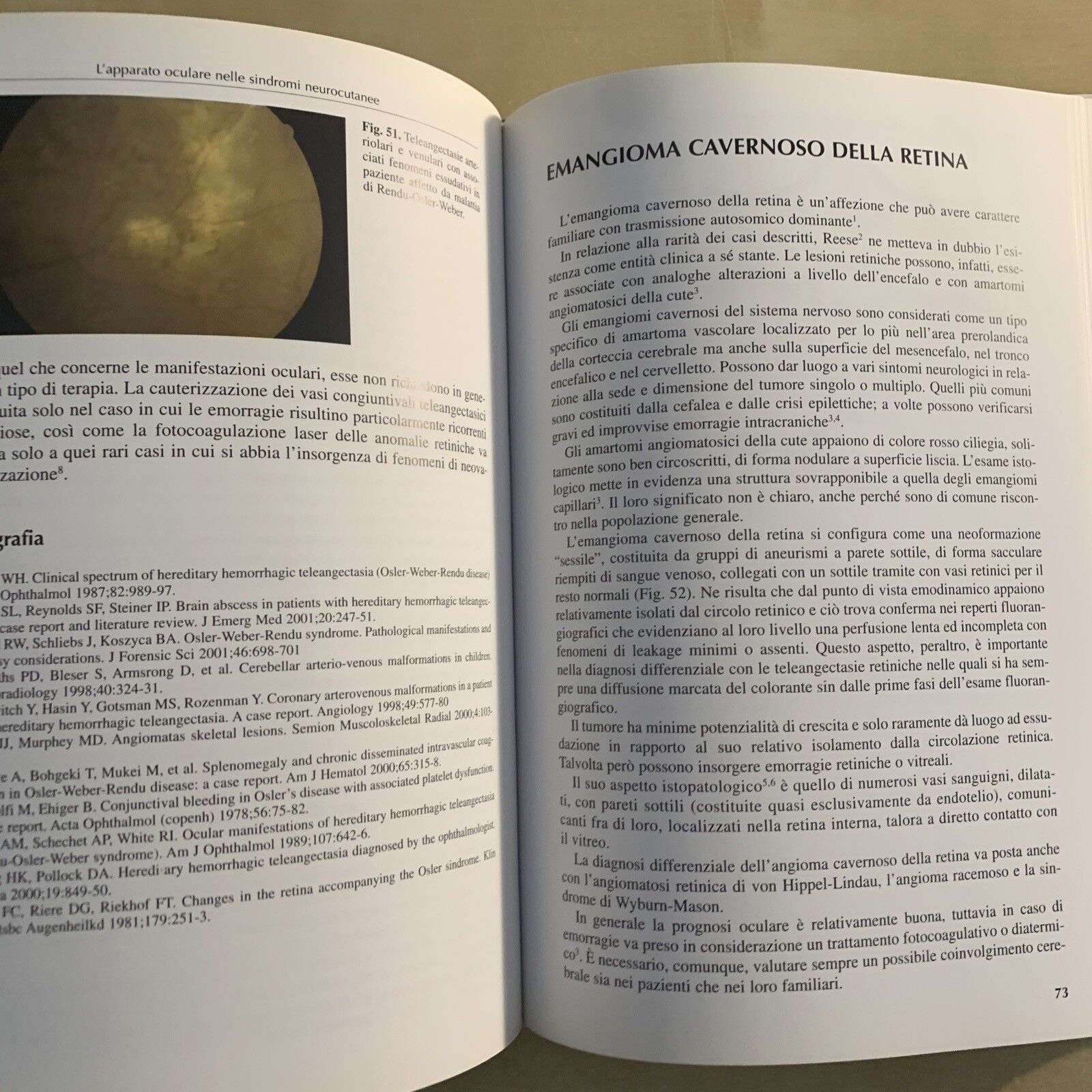 L'APPARATO OCULARE NELLE SINDROMI NEUROCUTANEE - Santi Maria recupero. Verduci #