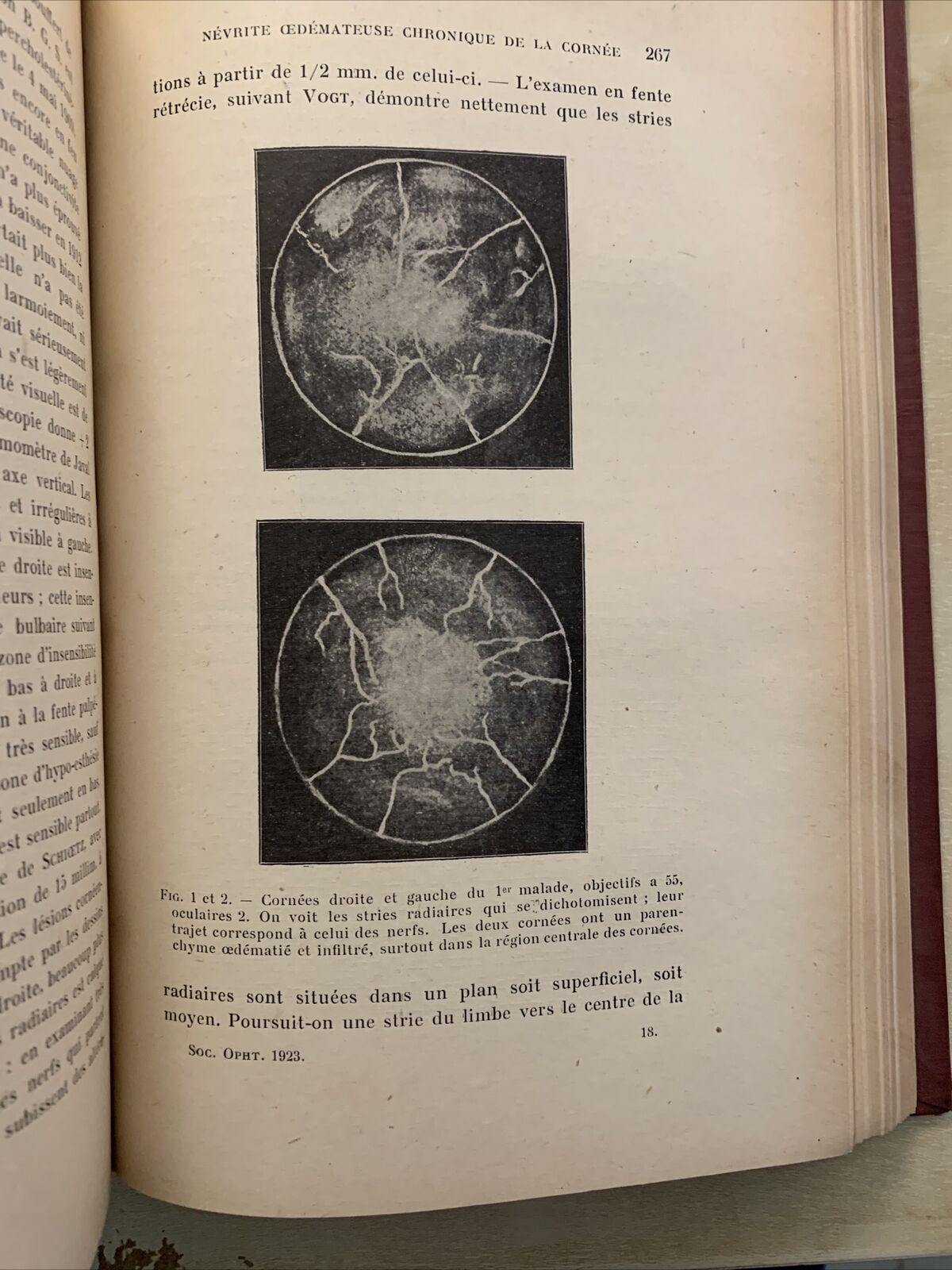Bulletins et memoires de la société francaise d'ophtalmologie vol. XXXVI 1923