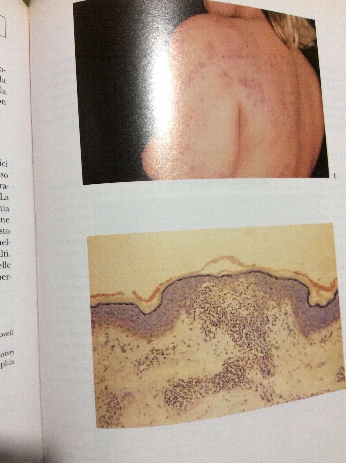 DERMATOLOGIA CLINICA,CAINELLI MARCHESI, 300  casi inusuali ,  McGraw-Hill, 2 vol