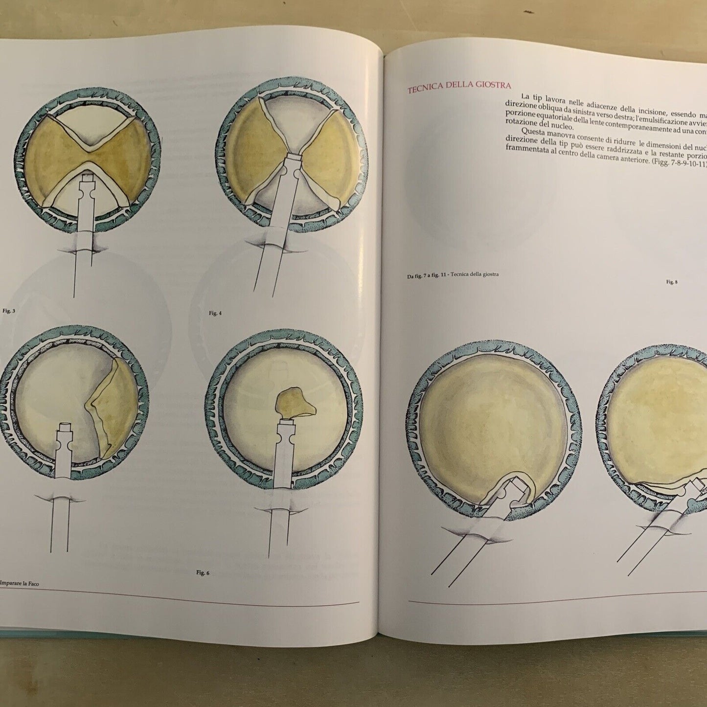 IMPARARE LA FACO - DAL FIUME E. , TASSINARI G. - FOGLIAZZA EDITORE 1992